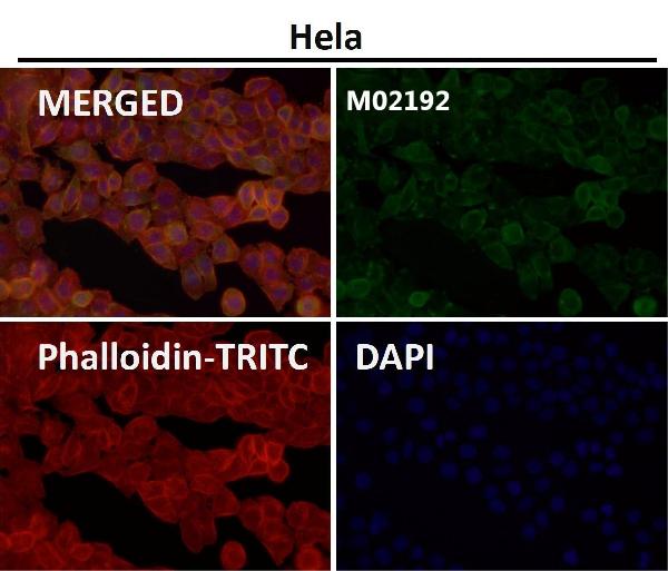 1 - Anti-Nesprin 1 Rabbit Monoclonal Antibody ABO14652