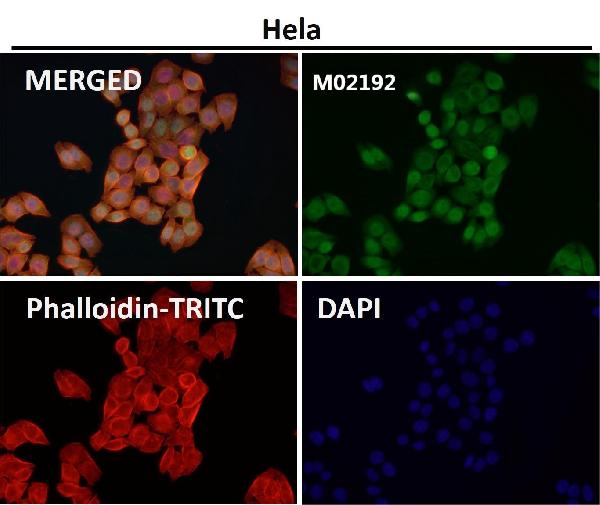 1 - Anti-Nesprin 1 Rabbit Monoclonal Antibody ABO14652
