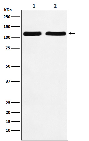 1 - Anti-Nesprin 1 Rabbit Monoclonal Antibody ABO14652