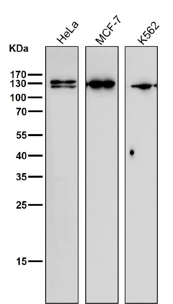 1 - Anti-Nesprin 1 Rabbit Monoclonal Antibody ABO14652