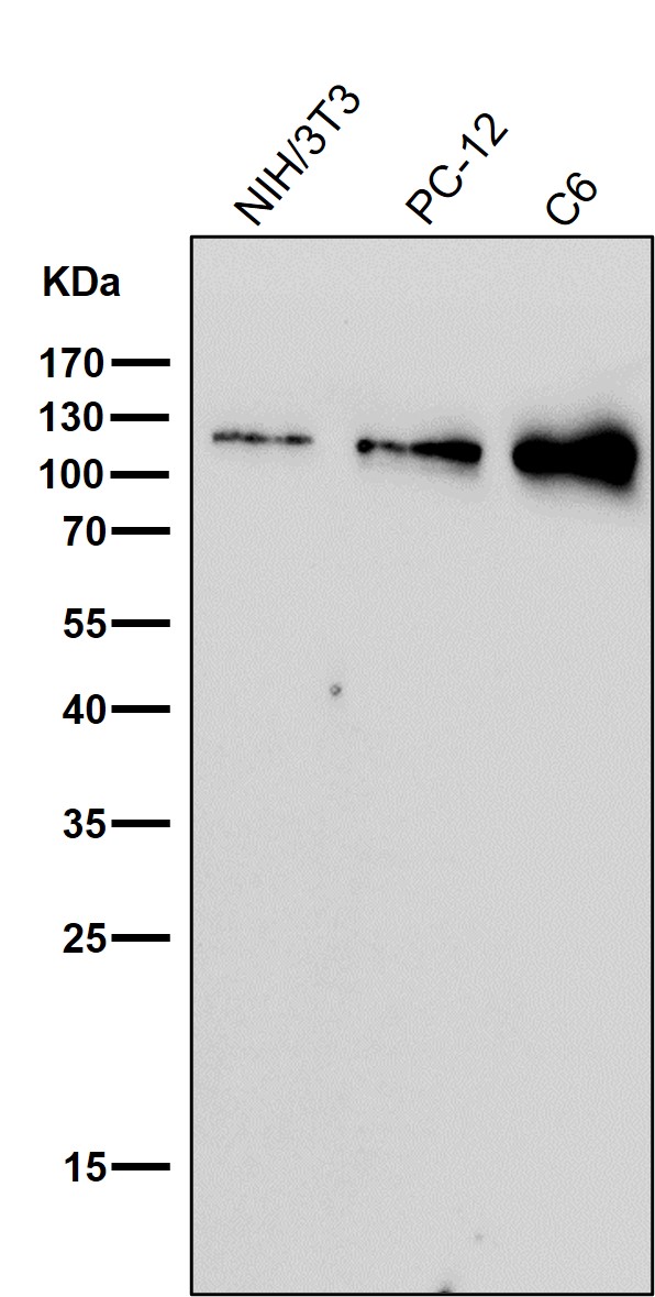 1 - Anti-Nesprin 1 Rabbit Monoclonal Antibody ABO14652