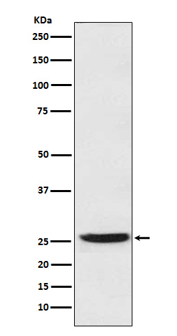 1 - Anti-PGDH Rabbit Monoclonal Antibody ABO14653