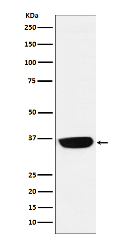 1 - Anti-PHOX2B Monoclonal Antibody ABO14654