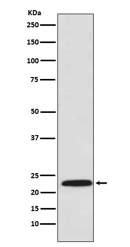 1 - Anti-PSMB8 / LMP7 Monoclonal Antibody ABO14656