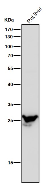 1 - Anti-PSMB8 / LMP7 Monoclonal Antibody ABO14656