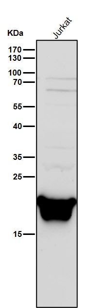 1 - Anti-PSMB8 / LMP7 Monoclonal Antibody ABO14656