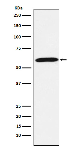 1 - Anti-Calsequestrin 1 Monoclonal Antibody ABO14661