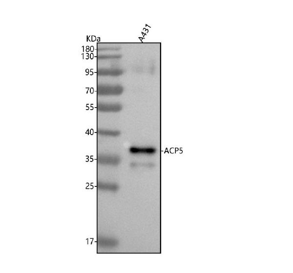 1 - Anti-TRAP ACP5 Monoclonal Antibody ABO14664