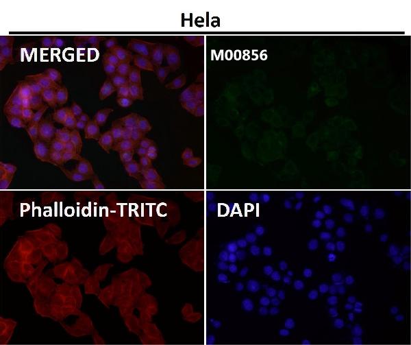 1 - Anti-KAT13A / SRC1 Monoclonal Antibody ABO14670