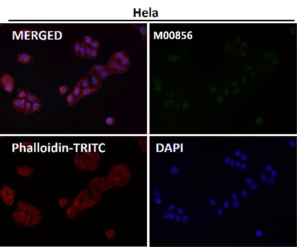 1 - Anti-KAT13A / SRC1 Monoclonal Antibody ABO14670