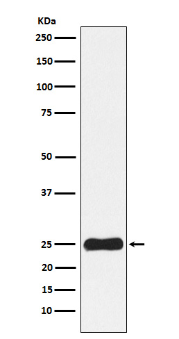 1 - Anti-Casein Kinase 2 beta Monoclonal Antibody ABO14673