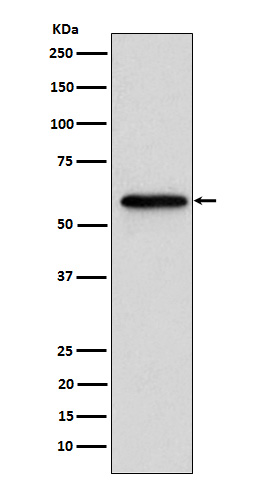 1 - Anti-Retinoic Acid Receptor beta RARB Monoclonal Antibody ABO14674