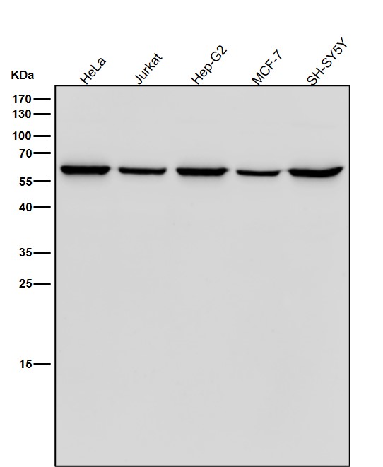 1 - Anti-Retinoic Acid Receptor beta RARB Monoclonal Antibody ABO14674