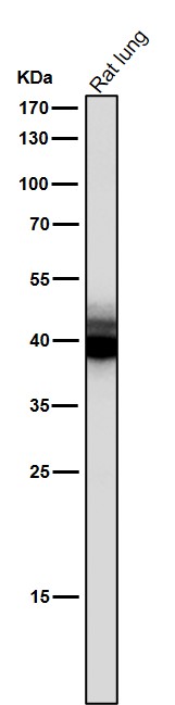 1 - Anti-Mesothelin Monoclonal Antibody ABO14676