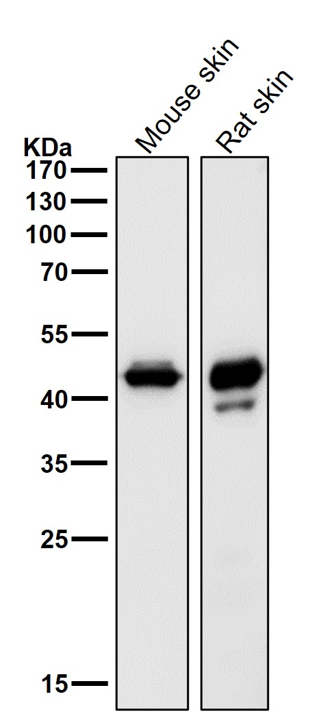 1 - Anti-SPI1 Rabbit Monoclonal Antibody ABO14683