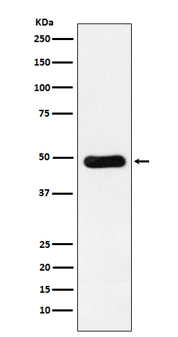 1 - Anti-RbAp48 Rabbit Monoclonal Antibody ABO14685