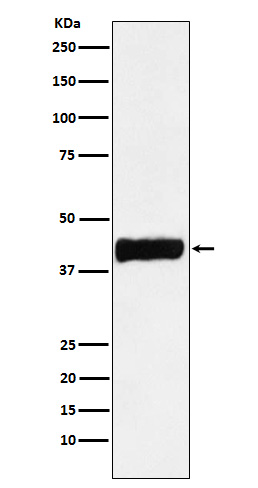 1 - Anti-Creatine kinase B type CKB Monoclonal Antibody ABO14689