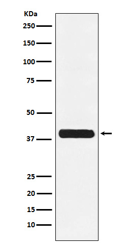 1 - Anti-Glycophorin C GYPC Monoclonal Antibody ABO14691