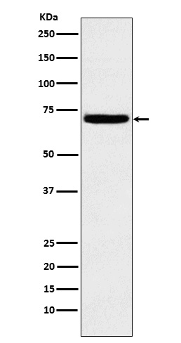 1 - Anti-Heparanase 1 HPSE Monoclonal Antibody ABO14692