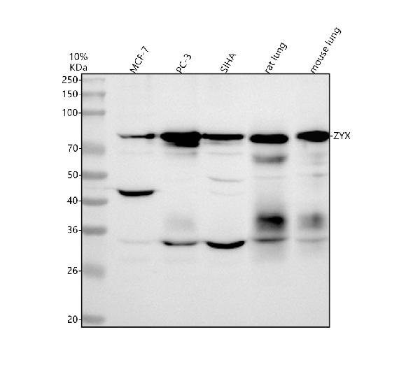 1 - Anti-Zyxin Monoclonal Antibody ABO14693