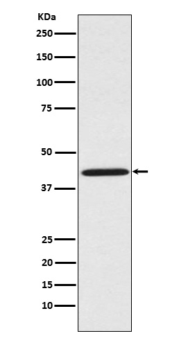 1 - Anti-Sprouty 2 SPRY2 Monoclonal Antibody ABO14694
