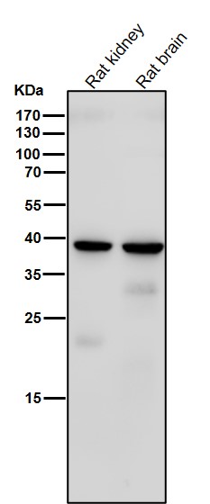 1 - Anti-Sprouty 2 SPRY2 Monoclonal Antibody ABO14694