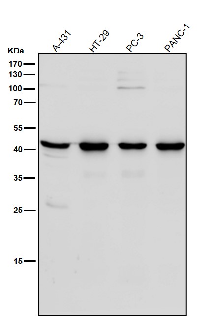 1 - Anti-Sprouty 2 SPRY2 Monoclonal Antibody ABO14694