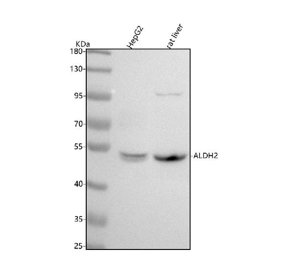 1 - Anti-ALDH2 Monoclonal Antibody ABO14695