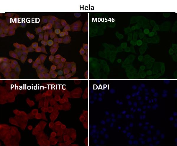 1 - Anti-ALDH2 Monoclonal Antibody ABO14695