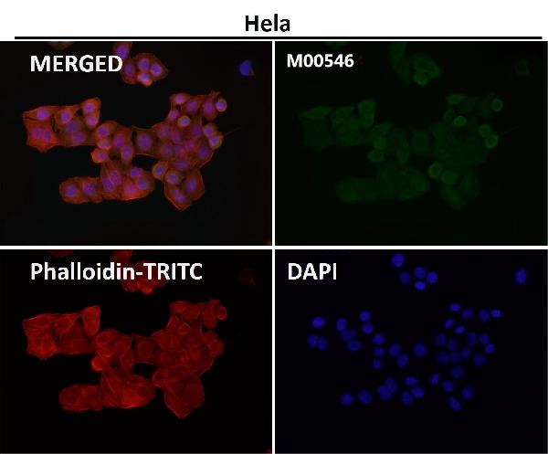 1 - Anti-ALDH2 Monoclonal Antibody ABO14695