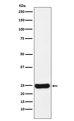 1 - Anti-Cathepsin S CTSS Monoclonal Antibody ABO14697