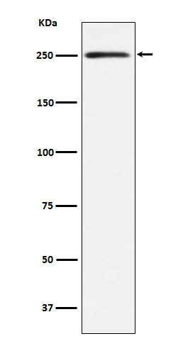 1 - Anti-MYH11 Rabbit Monoclonal Antibody ABO14699