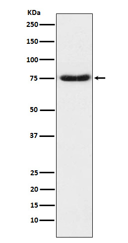 1 - Anti-Netrin 1 NTN1 Monoclonal Antibody ABO14700