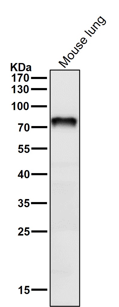1 - Anti-Netrin 1 NTN1 Monoclonal Antibody ABO14700