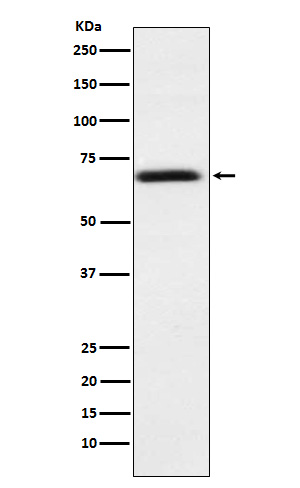 1 - Anti-PMP70 ABCD3 Monoclonal Antibody ABO14702