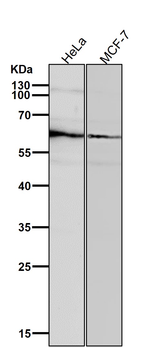 1 - Anti-PMP70 ABCD3 Monoclonal Antibody ABO14702