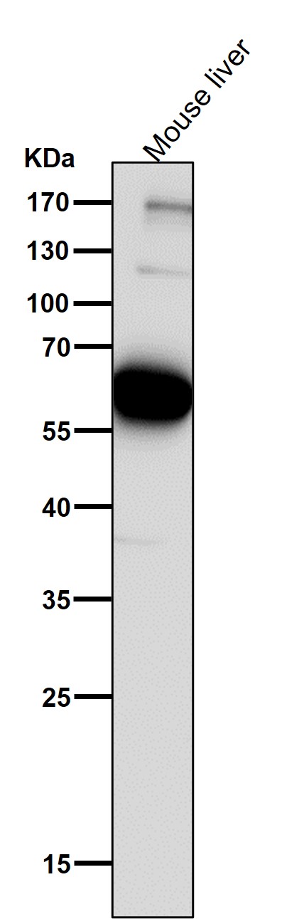 1 - Anti-PMP70 ABCD3 Monoclonal Antibody ABO14702