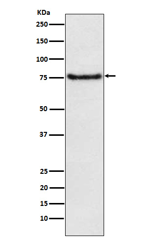 1 - Anti-BDKRB2 Monoclonal Antibody ABO14703