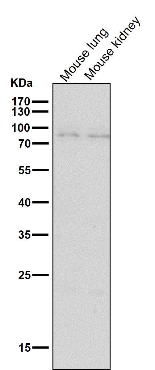 1 - Anti-BDKRB2 Monoclonal Antibody ABO14703