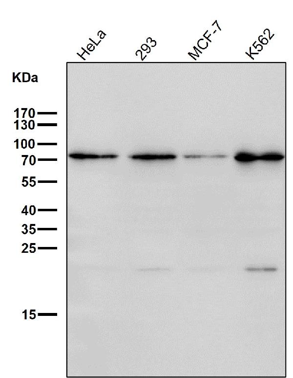 1 - Anti-BDKRB2 Monoclonal Antibody ABO14703