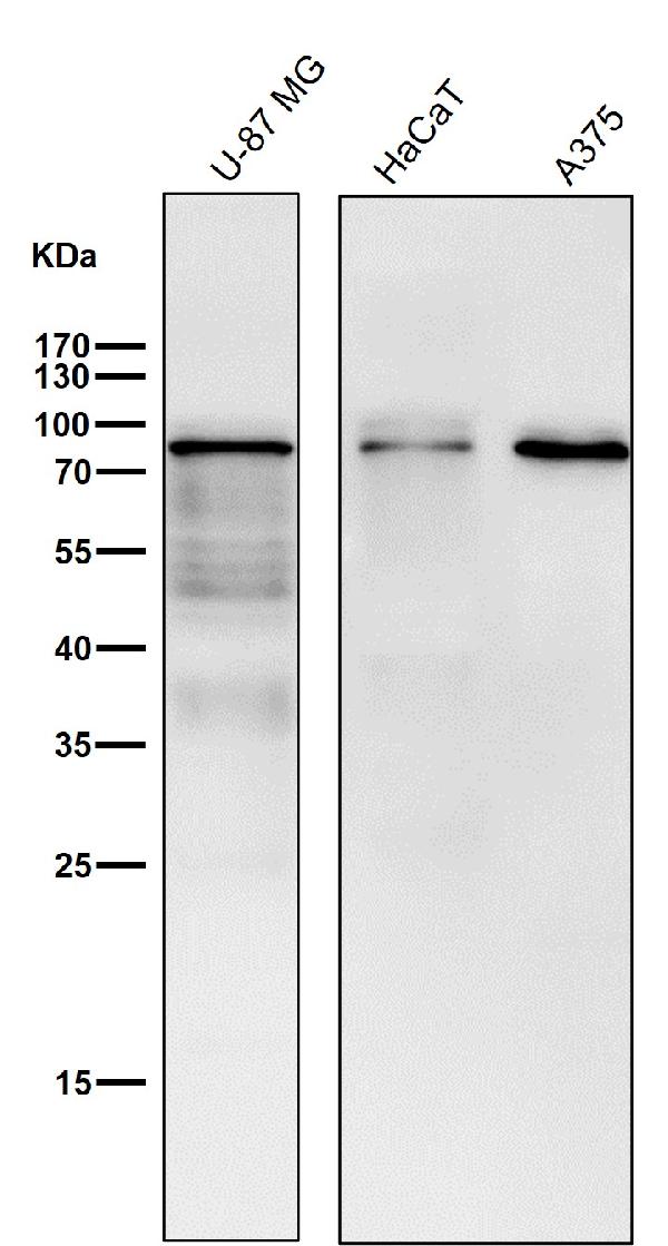 1 - Anti-BDKRB2 Monoclonal Antibody ABO14703