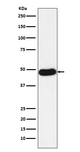 1 - Anti-Napsin A NAPSA Monoclonal Antibody ABO14708