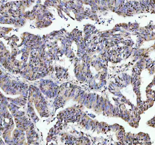 2 - Anti-FKBP51 Monoclonal Antibody ABO14711