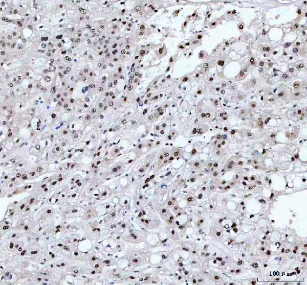 2 - Anti-FKBP51 Monoclonal Antibody ABO14711