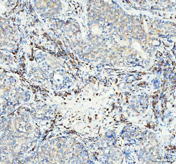 2 - Anti-Neurokinin 1 Receptor Monoclonal Antibody ABO14714