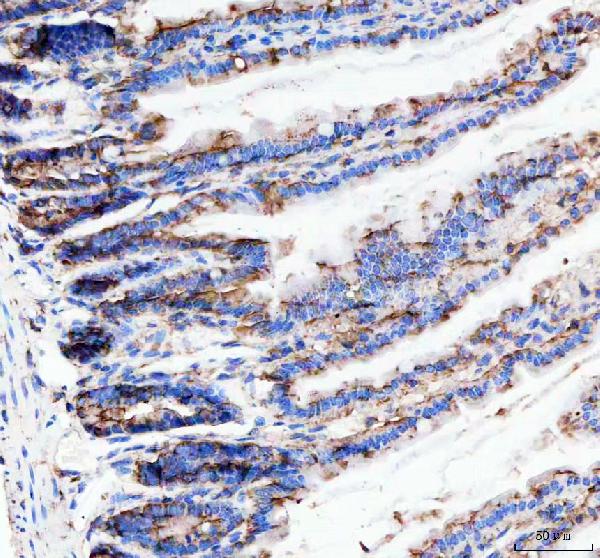 2 - Anti-Neurokinin 1 Receptor Monoclonal Antibody ABO14714