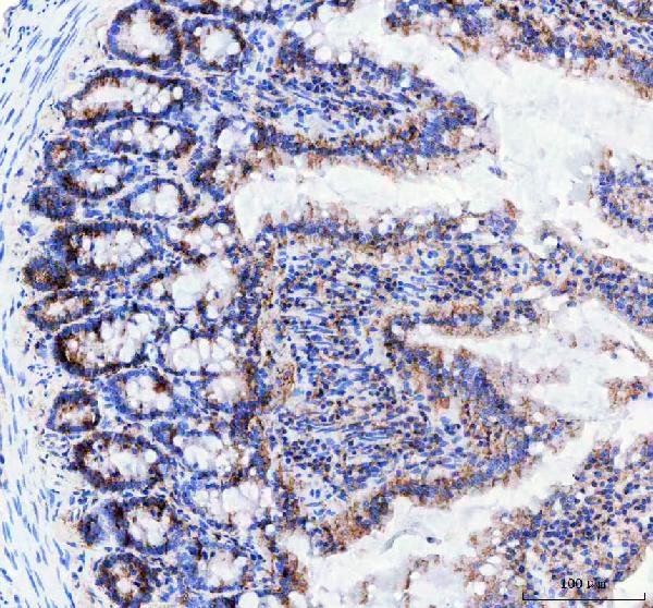 2 - Anti-Neurokinin 1 Receptor Monoclonal Antibody ABO14714