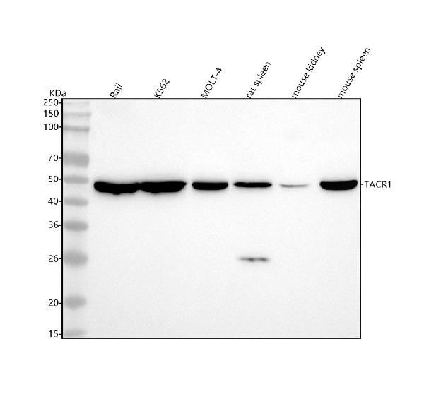 1 - Anti-Neurokinin 1 Receptor Monoclonal Antibody ABO14714