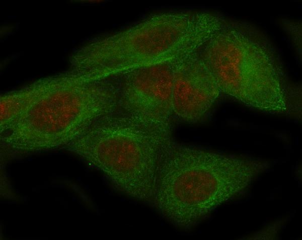 3 - Anti-ADAR1 Monoclonal Antibody ABO14718