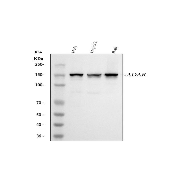 1 - Anti-ADAR1 Monoclonal Antibody ABO14718